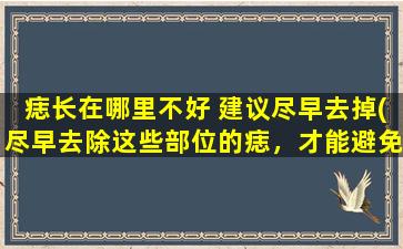 痣长在哪里不好 建议尽早去掉(尽早去除这些部位的痣，才能避免潜在危险并美化容颜)